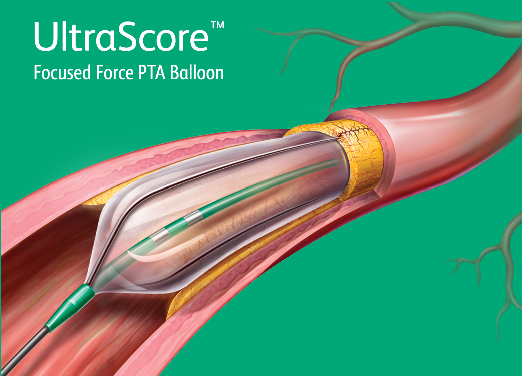 PADresourcesultrascore - 1.jpg